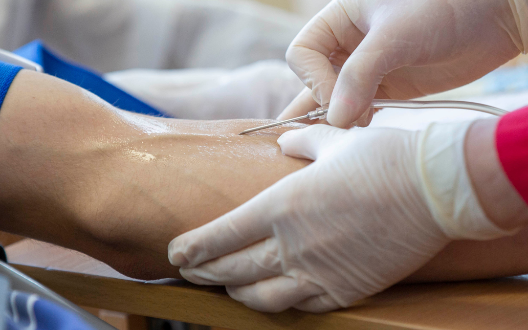 Revitalize Your Body: Exploring IV Infusion Therapy in Arcadia, California